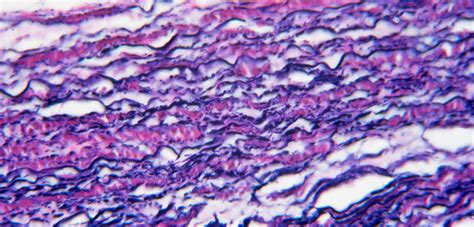 [DIAGRAM] Diagram Of Elastic Tissue - MYDIAGRAM.ONLINE