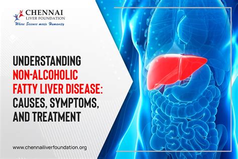 Understanding Non-Alcoholic Fatty Liver Disease: Causes, Symptoms, and Treatment - Chennai Liver ...