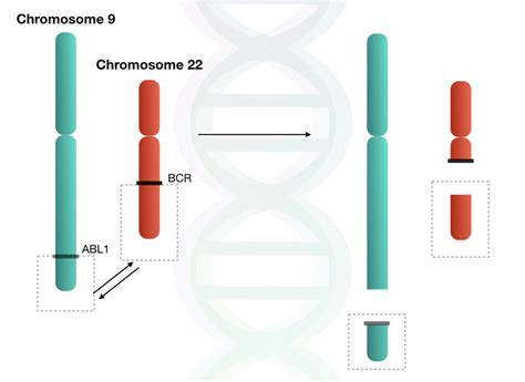 What is Philadelphia Chromosome?- BCR-ABL1 Gene Fusion and CML