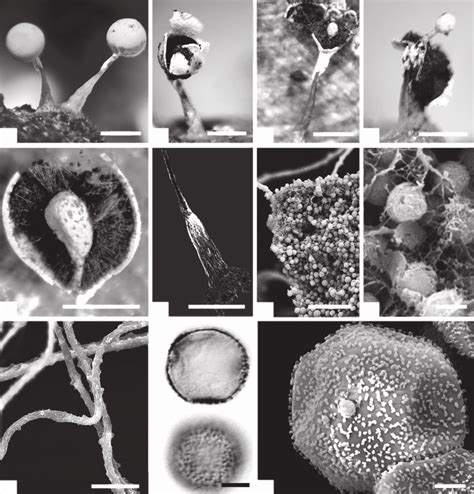 Sporocarp and spore morphology of Diderma novae-zelandiae (SLS 9653 ...