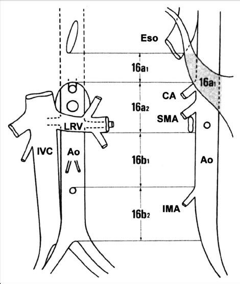 Anatomic de fi nitions of para-aortic lymph nodes. 15 | Download Scientific Diagram