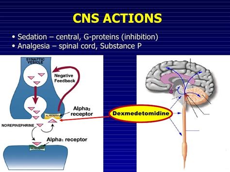 Dexmedetomidine For Pediatric Procedural Sedation