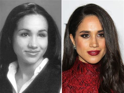 Meghan Markle's Nose Is Now The Most Popular Plastic Surgery Request – Lipstiq.com