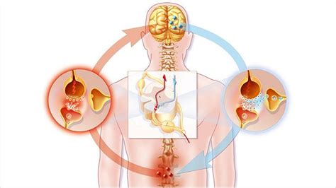 The Best Ways to Treat and Control Neuropathic Pain - Pinnacle Marketing