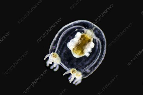 Jellyfish larva, LM - Stock Image - C019/9618 - Science Photo Library