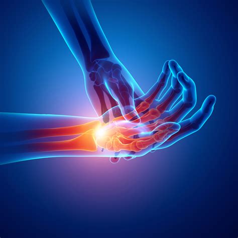 Top Causes of Hand Pain - Stem Cell Chicago