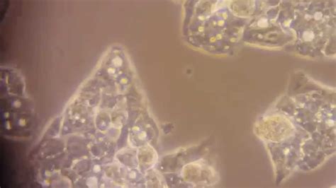 HepG2 cells with a bit extra - YouTube