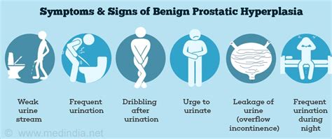 Prostate | Activation Clinic