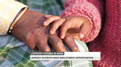 The stigma of leprosy in India - YouTube