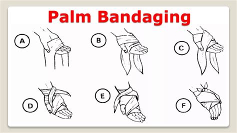 Triangular Bandage Techniques