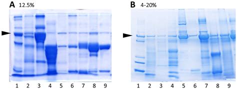 Diagnostics | Free Full-Text | SDS Electrophoresis on Gradient Polyacrylamide Gels as a ...