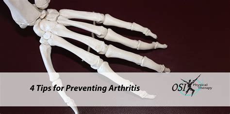 4 Tips for Preventing Arthritis