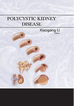 Implications of Dysfunction of Mechanosensory Cilia in Polycystic Kidney Disease | Exon Publications