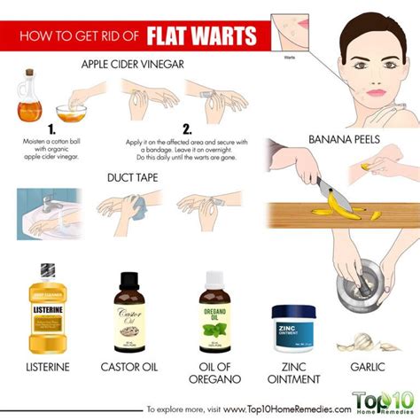 How to Get Rid of Flat Warts | Top 10 Home Remedies