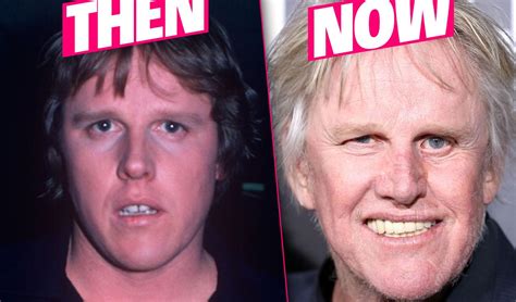 Gary Busey Admits Plastic Surgery Makeover In New Tell-All Book