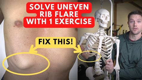 How To Fix Uneven Rib Flare with 1 Exercise! (you've never tried this ...