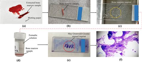 Pictorial representation of pre-and post-processing procedure of... | Download Scientific Diagram