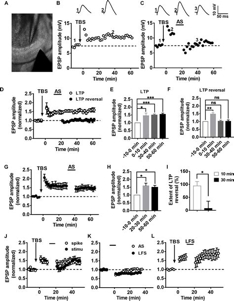 Frontiers | Development of Depotentiation in Adult-Born Dentate Granule Cells