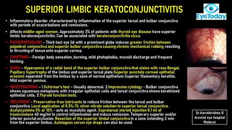 Superior Limbic Kerato-conjunctivitis - EyeToday