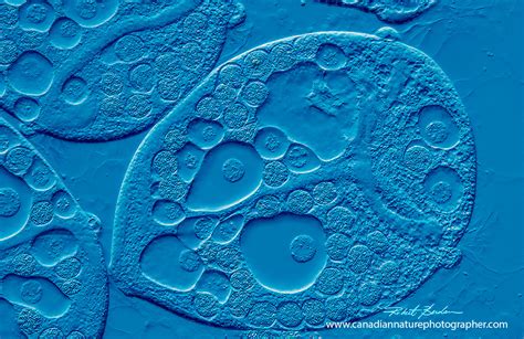 Differential Interference Contrast Microscopy (DIC) - The Canadian Nature Photographer - Robert ...