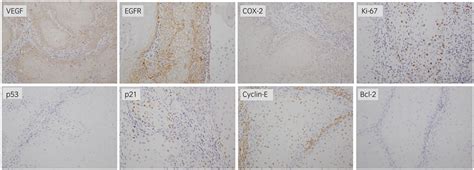 Results of IHC. The expression level of each biomarker was evaluated ...