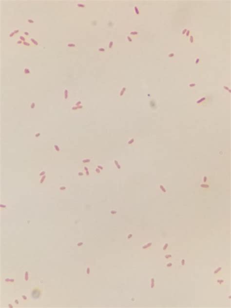 Gram stain showing Aeromonas which are a gram-negative facultative ...