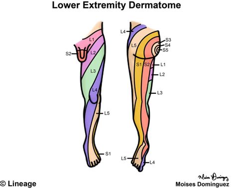 Dermatomes Neurology Medbullets Step 1 | Dermatome Map