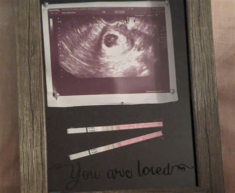 Miscarriage_and_pregnancy_loss_-Ashley_Hilliard_ultrasound-cropped