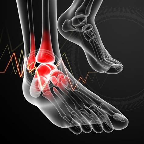 5 Different Types of Arthritis That Affect Your Feet | Ankle Surgery in ...