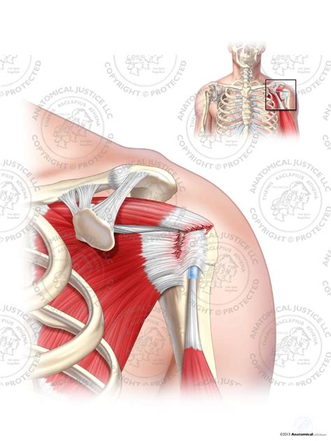 Supraspinatus Anatomy - Anatomical Charts & Posters