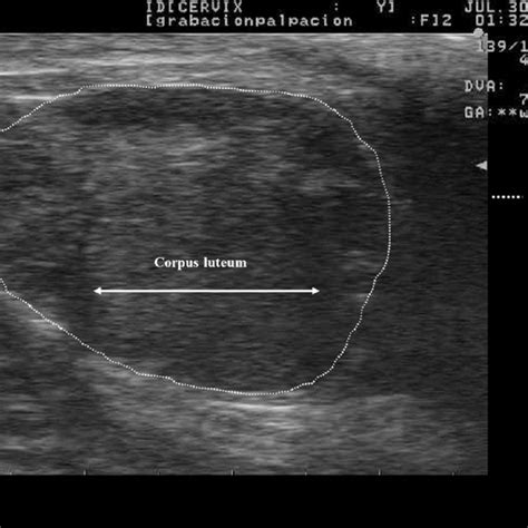 Ultrasound image of a bovine ovary with corpus luteum. | Download Scientific Diagram