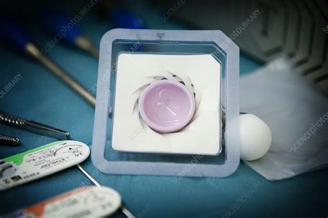 Hip Prosthesis, Surgery - Stock Image - C017/0219 - Science Photo Library