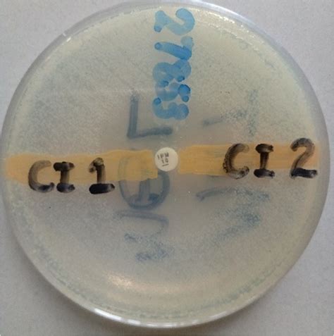 Figure 4. Chryseobacterium indologenes isolate tested for the production of metallo-β-lactamase ...