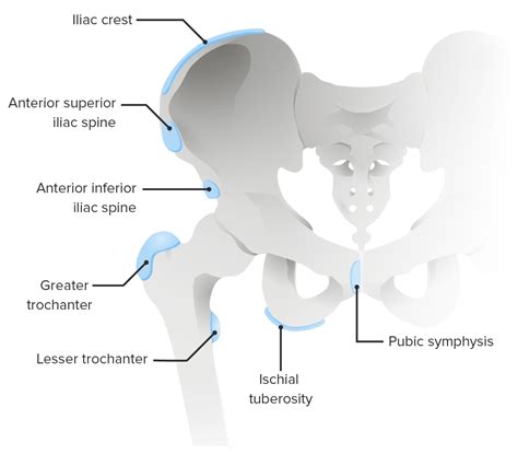 Chronic Apophyseal Injury | Concise Medical Knowledge