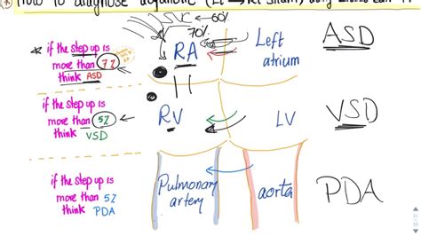 Cardiac Shunt Study