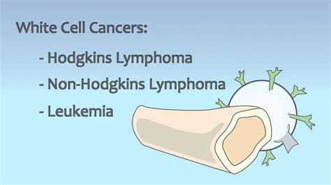 Video 18 Blood and Immune System Disorders - YouTube