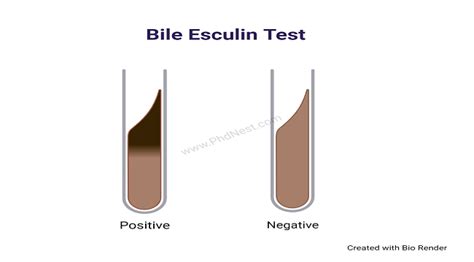 Bile Esculin Test: Objective, Principle, Procedure, Result, Uses ...