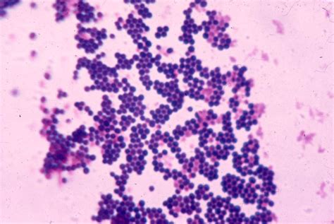 Pin on Staph Aureus Gram stain