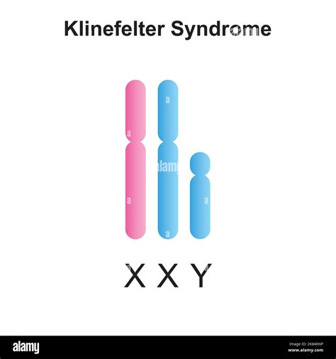 Xxxy Chromosome Syndrome