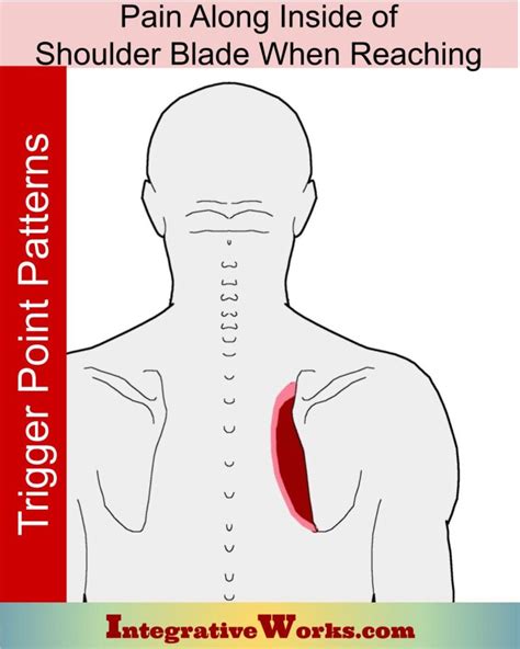 Pain along Shoulder Blade when Reaching Up or Back - Integrative Works