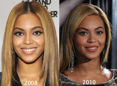 Beyonce Plastic Surgery Before and After Photos