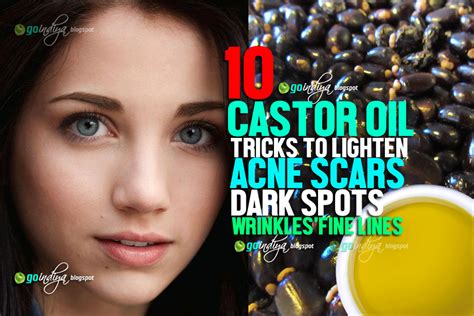 10 Tricks to Lighten Acne Scars, Dark spots with Castor Oil? - Natural Home Remedies. Simple and ...