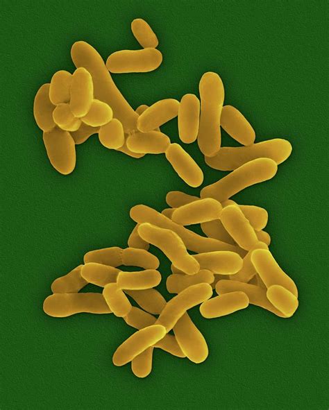 Mycobacterium Tuberculosis #8 Photograph by Dennis Kunkel Microscopy ...