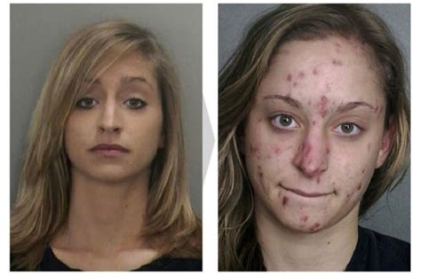 18 Disturbing Before And After Pictures Of Faces Transformed By Drug Abuse | LifeCrust