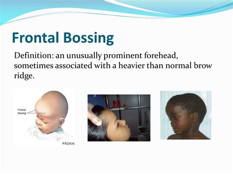 PPT - CLINICAL MANIFESTATIONS OF HEREDITY ANOMALIES PowerPoint Presentation - ID:9602267