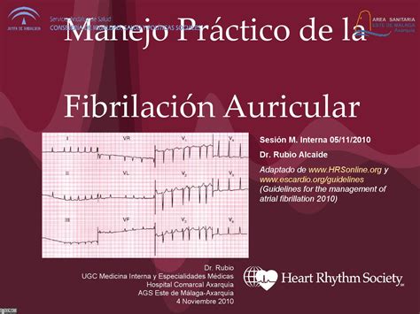 Manejo Práctico de la Fibrilación Auricular by FormacionAxarquia ...