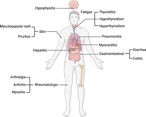 Frontiers | Checkpoint inhibitor immune-related adverse events: A ...