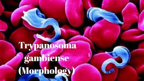 Trypanosoma gambiense ( morphology) - YouTube