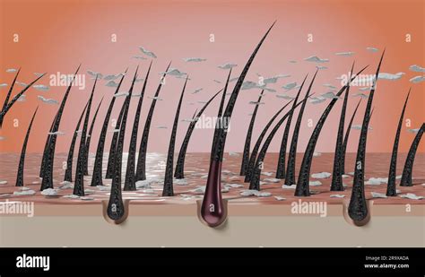 Hair follicles and dandruff under microscope - 3D illustration Stock Photo - Alamy