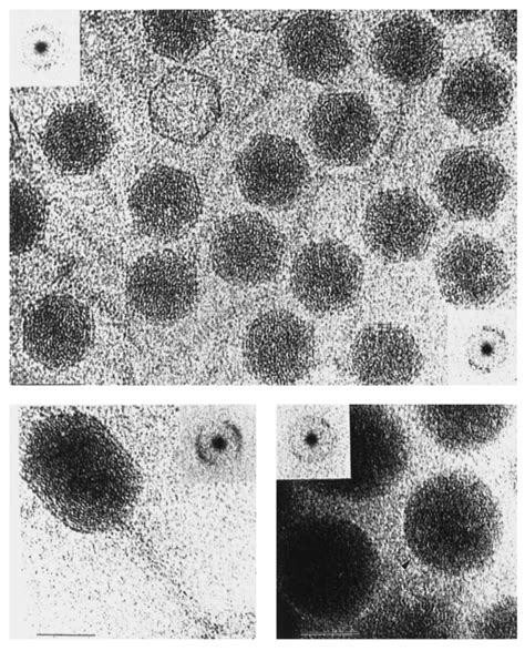 A bacteriophage imaged under conditions best revealing the packaging of ...